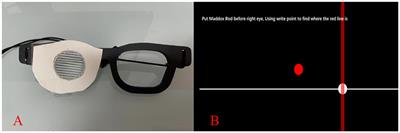 Assessment of precision and reliability of a novel computerized heterophoria test